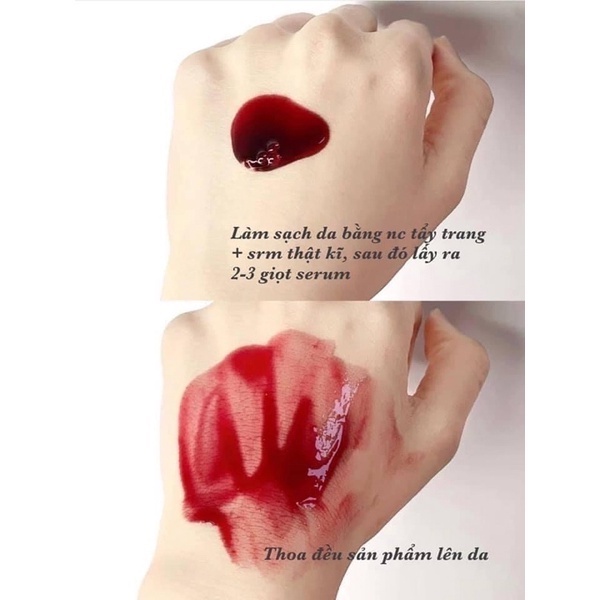 Serum tẩy tế bào chết hoá học The Ordinary AHA 30% + BHA 2% Peeling solution