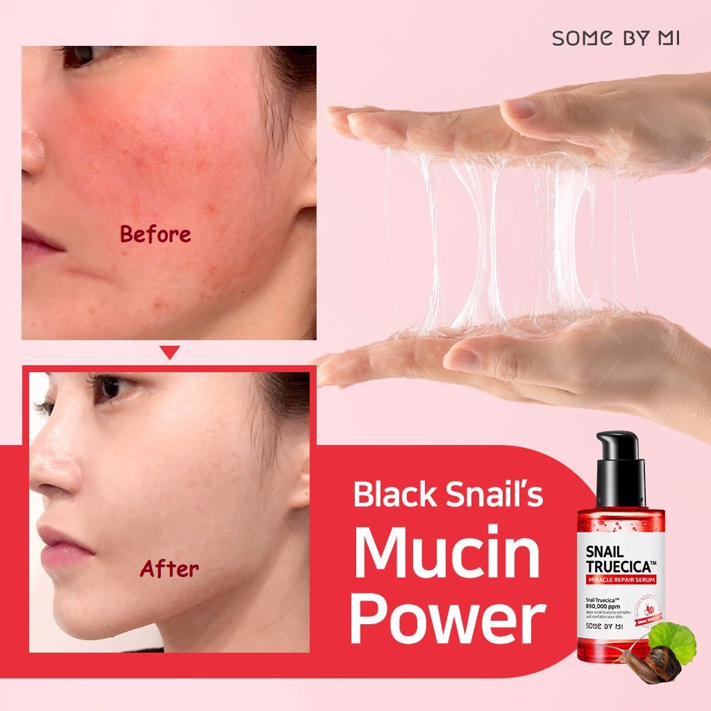 Serum ốc sên - Tinh chất ốc sên dưỡng da phục hồi sẹo Some By Mi Snail Truecica Miracle Repair 50ml Auth Hàn Quốc