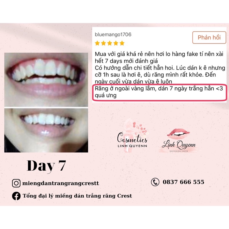 Miếng dán trắng răng Crest Gentle Doux (Răng nhạy cảm) - Combo 7 gói