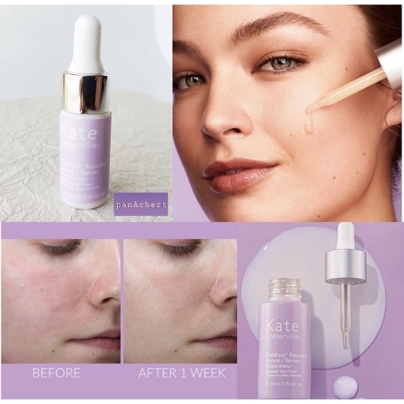 Tinh chất phục hồi Kate Somerville’s DeliKate Recovery Serum