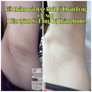 SIRUM JIUHE VUA TRỊ THÂM
