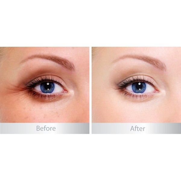 Serum Balance dưỡng da mắt Active Formula Gold+ Marine Collagen Rejuvenating Eye Serum 15ml Meow Beauty Shop
