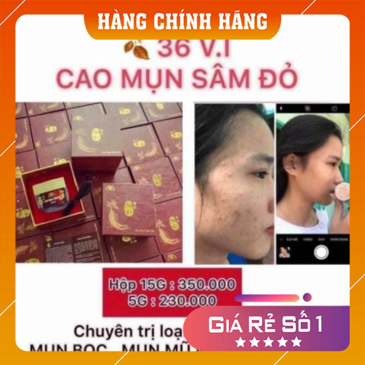 Cao Mụn Sâm Đỏ FREESHIP Cao Mụn Sâm Đỏ Lớn 15g  - Dứt điểm tất cả các tình trạng mụn nặng nhất