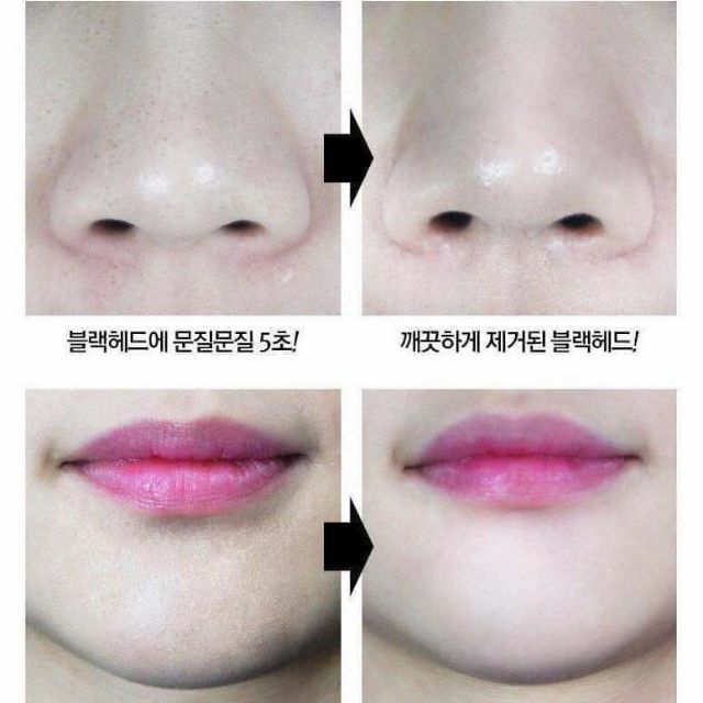 Miếng dán lột mụn Luke tinh chất than tre Hàn Quốc | Thế Giới Skin Care