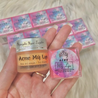 Acne Mỹ Lyn