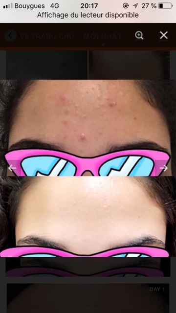 Kem retinol a313 chuẩn nội địa Pháp | BigBuy360 - bigbuy360.vn