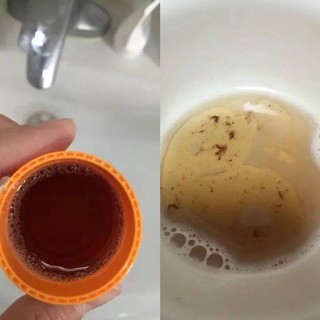 Nước Súc Miệng Nhật Bản Propolinse
