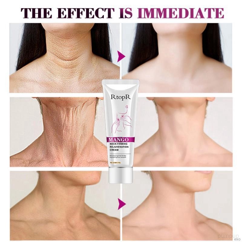 Kem Làm Săn Chắc Trẻ Hóa Da Vùng Cổ Chống Nếp Nhăn RtopR