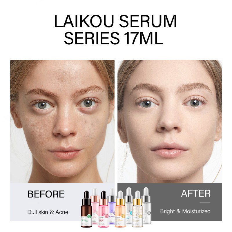 [Hàng mới về] Serum Laikou Chứa Hyaluronic Acid / Vitamin C / Tinh Chất Vàng 24k / Ốc Sên / Trà Xanh Giúp Làm Trắng Da