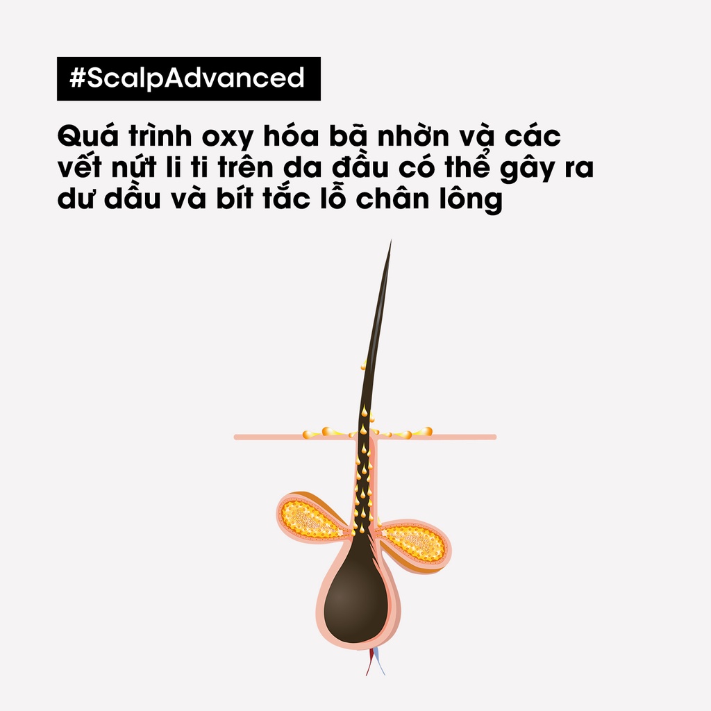 Dầu gội dưỡng tóc giảm bã nhờn da đầu, giảm bết tóc Scalp Advanced 500ml - Dành cho da đầu dư dầu, tóc bết