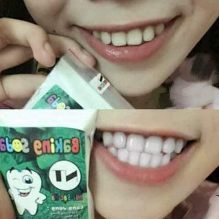 BỘT TRẮNG RĂNG BAKINGSODA 50k