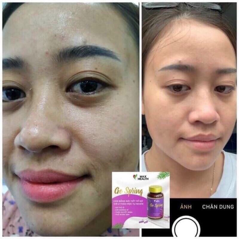 KV Beauty- Nội tiết tố nữ Go.Spring (chính hãng)