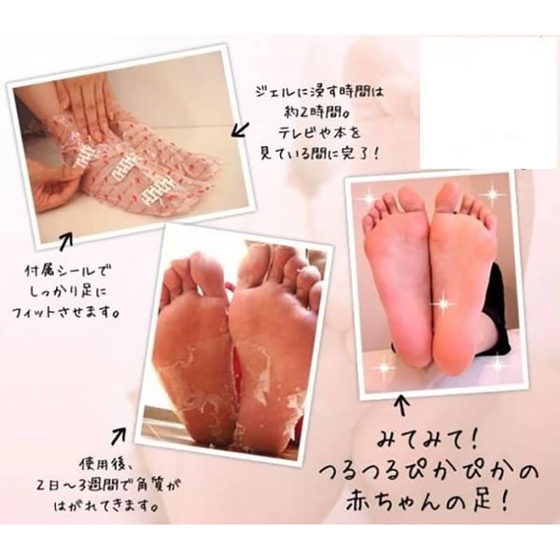 Túi ủ bong da chết bàn chân New My Pure Foot - Nhật Bản