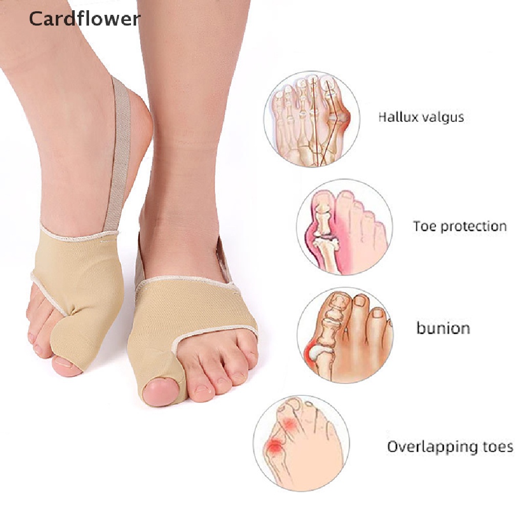 1 Cặp Nẹp Chỉnh Hình Ngón Chân Cái