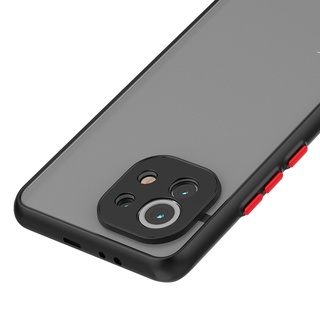 Ốp lưng Redmi Note 11 Pro Note 11s Note 7 Note 8 Note 9  Pro Note 9s Note 10 10s 9T 9A Mi 11 Lite 5G đen nhám [Basic]