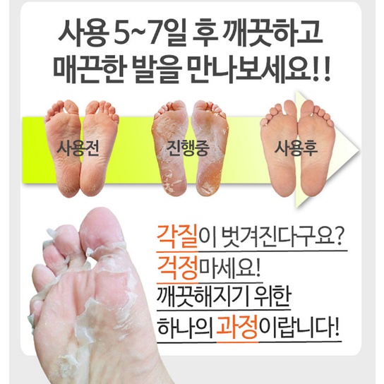 BỘ 2 TÚI MẶT NẠ THAY DA CHÂN PUREDERM SHINY & SOFT FOOT PEELING MASK