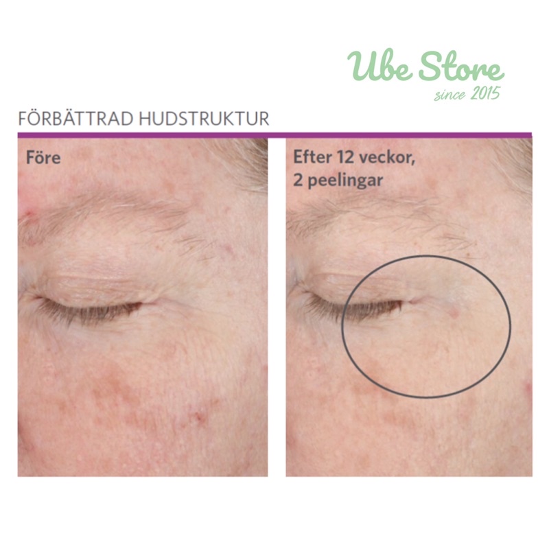 PEEL DA TẠI NHÀ NEOSTRATA RETINOL PEEL (1 ỐNG)