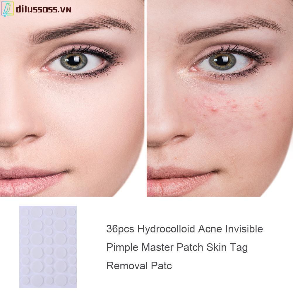 Bộ 24/36 miếng dán Hydrocolloid hỗ trợ loại bỏ mụn thoáng khí chăm sóc da mặt