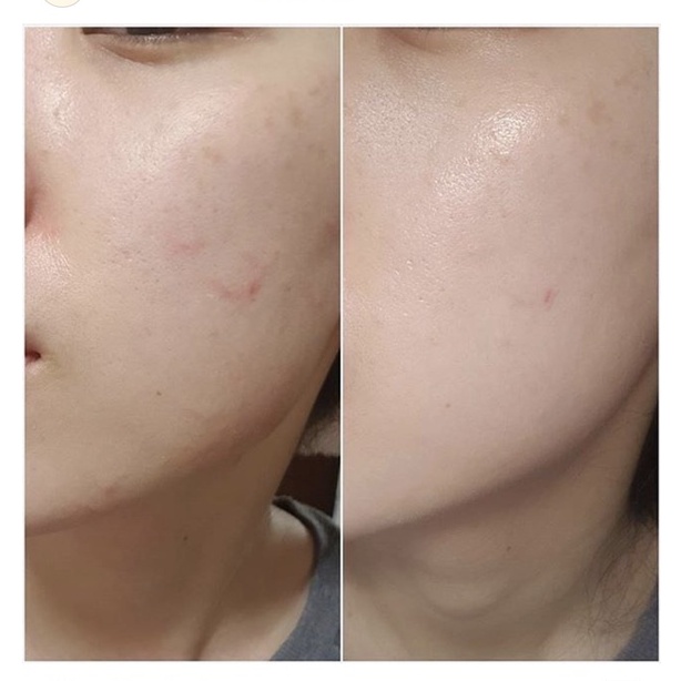 Kem Chống Nắng Nâng Tông Da, Lành Tính Chiết Xuất Rau Má Skin1004 Madagascar Centella Air-Fit Suncream SPF50+/PA++++ | BigBuy360 - bigbuy360.vn