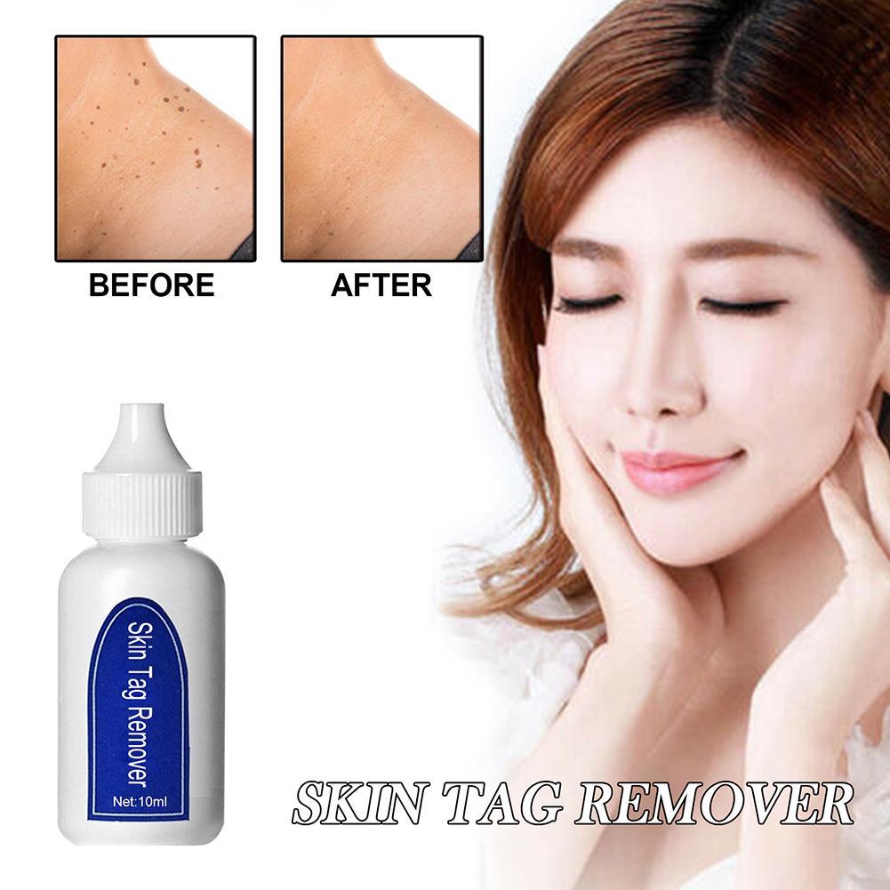 (Hàng Mới Về) Dung Dịch Trị Mụn Cóc 6ml Agai E6M6