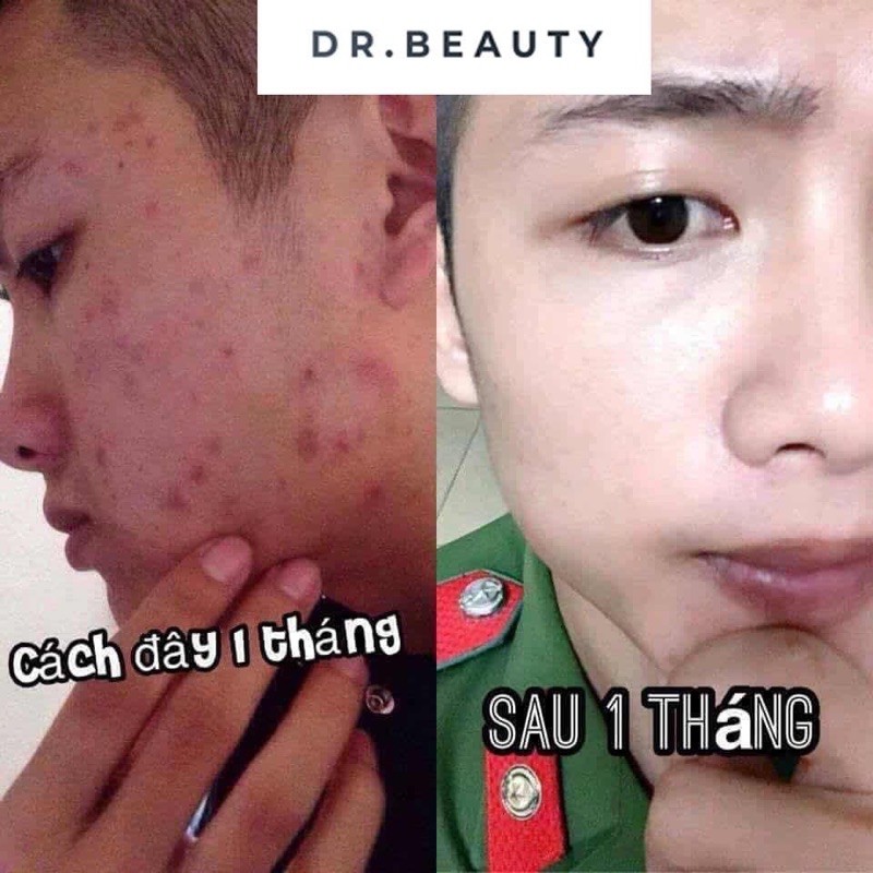 SERUM MỤN DR.BEAUTY ngăn ngừa và làm giảm mụn trên da, làm mờ các vết thâm do mụn