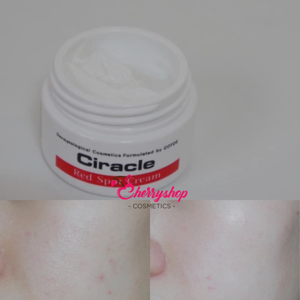 KEM MỤN VÀ VẾT THÂM &quot; - Ciracle Red Spot Cream