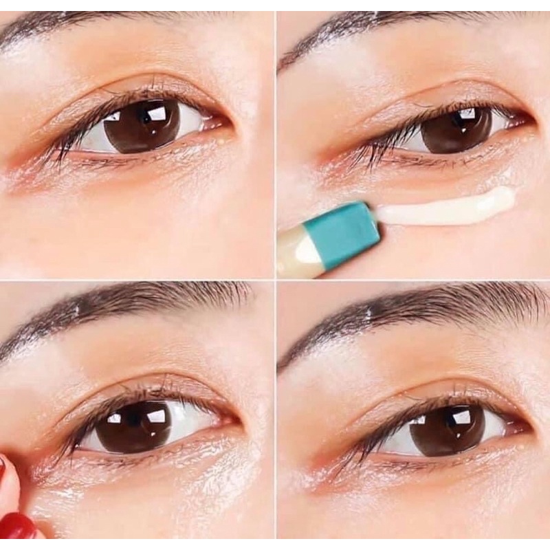 Kem mắt ahc( mẫu mới 2021)