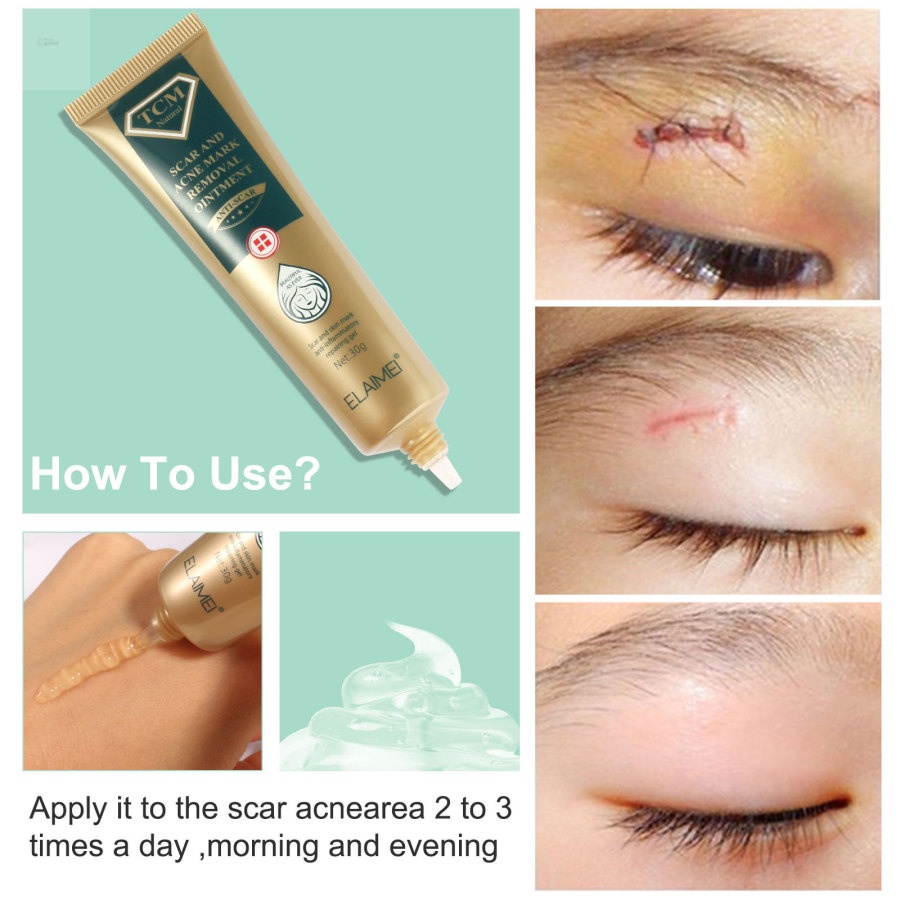 Gel Hỗ trợ giảm sẹo Và Mụn GLAMN ELAIMEI