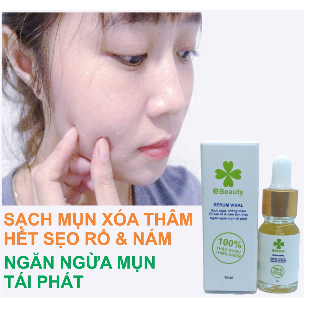 Serum tri mụn xóa thâm sẹo rổ nám tàn nhang EBeauty Viral 10ml | BigBuy360 - bigbuy360.vn