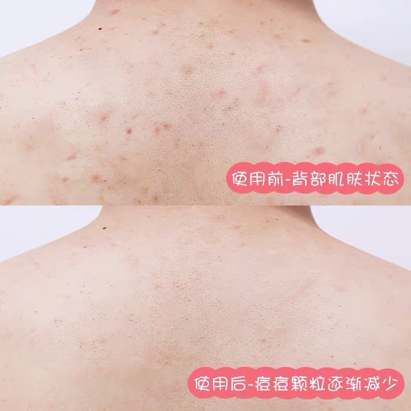 Tẩy Da Chết Trắng Da Body Trái Cây HEYXI CRUB BATH Loại Bỏ Bụi Bẩn Đánh Bay Mụn Thâm Toàn Thân Đào Xoài Kiwi Việt Quất