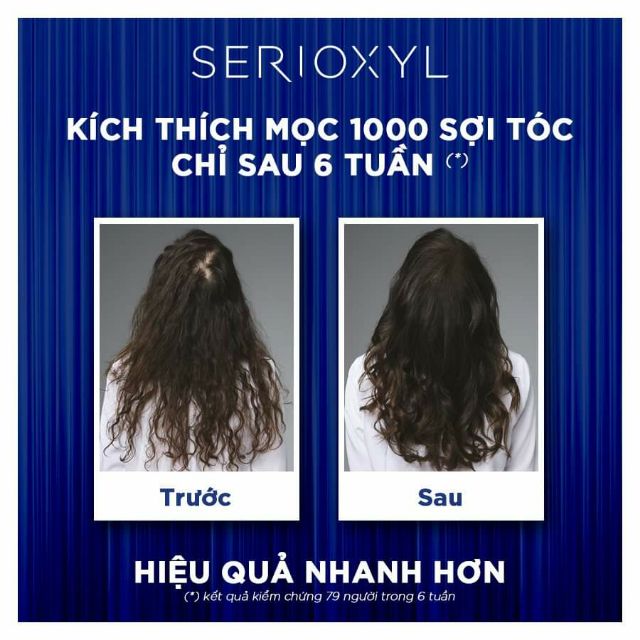 TINH CHẤT MỌC TÓC 1700 SỢI TRONG 6 TUẦN L'OREAL SERIOXYL DENSER HAIR 90ML