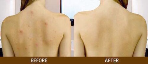  SỮA TẮM ADERMA Pháp 500ml