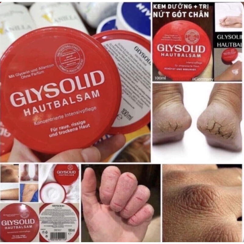 Kem dưỡng cho da thô sần nứt nẻ Glysolid