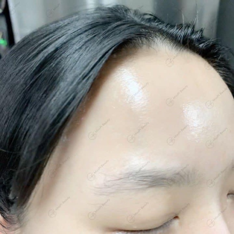 Kem dưỡng Vitamin K Ahohwa Cream - phục hồi cho da mao mạch , da mõng đỏ và chống lão hóa, ngăn ngừa nếp nhăn