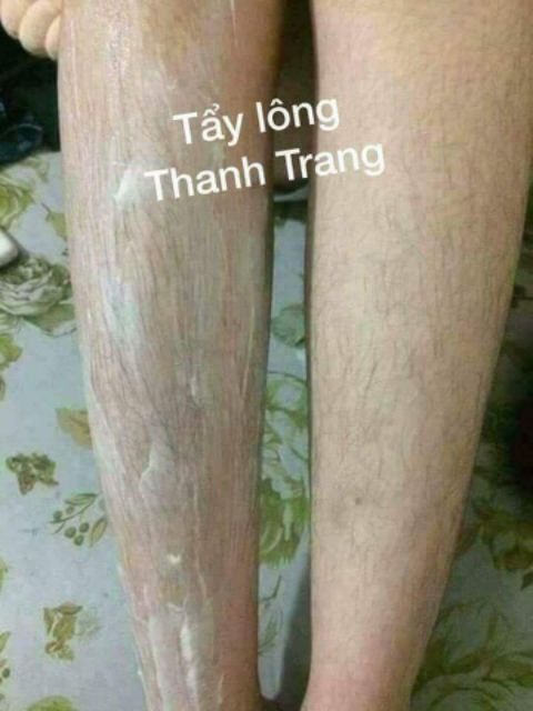Kem tẩy lông Thanh Tranh | BigBuy360 - bigbuy360.vn