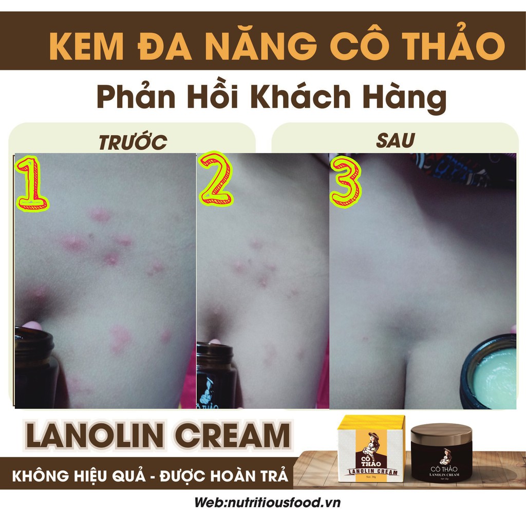 Kem dưỡng ẩm da đa năng CÔ THẢO - Kem dưỡng ẩm cho Bé mềm da hết chàm sữa, hăm da - Mã: BEP019