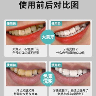 [Hàng mới về] Miếng dán làm trắng răng 5D