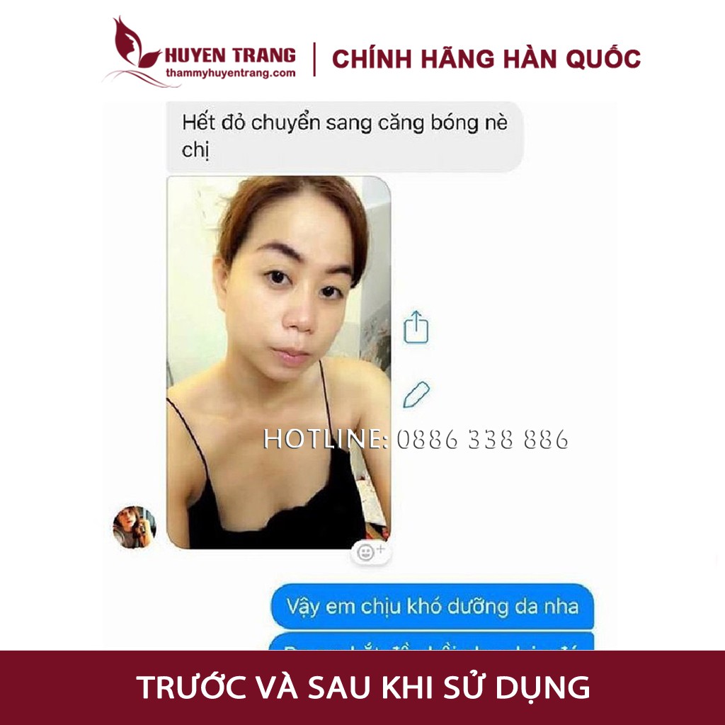 Tế Bào Gốc Hàn Quốc RONAS, serum chăm sóc da, trắng da, se khít, mờ thâm, nám, căng bóng, trẻ hóa da (Tặng nút chiết)