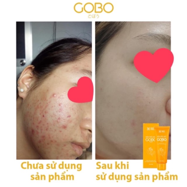 Sữa rửa mặt Gobo làm sạch sâu Cỏ Cây Hoa Lá 100g | BigBuy360 - bigbuy360.vn