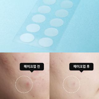 Miếng dán mụn CARE PLUS của OLIVE YOUNG