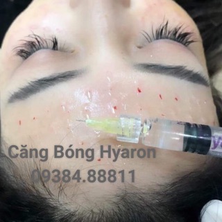 KIM MESO 32G *4MM = 100 cây 💯