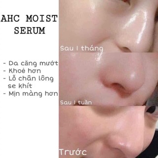 SERUM AHC - Mẫu mới 2020