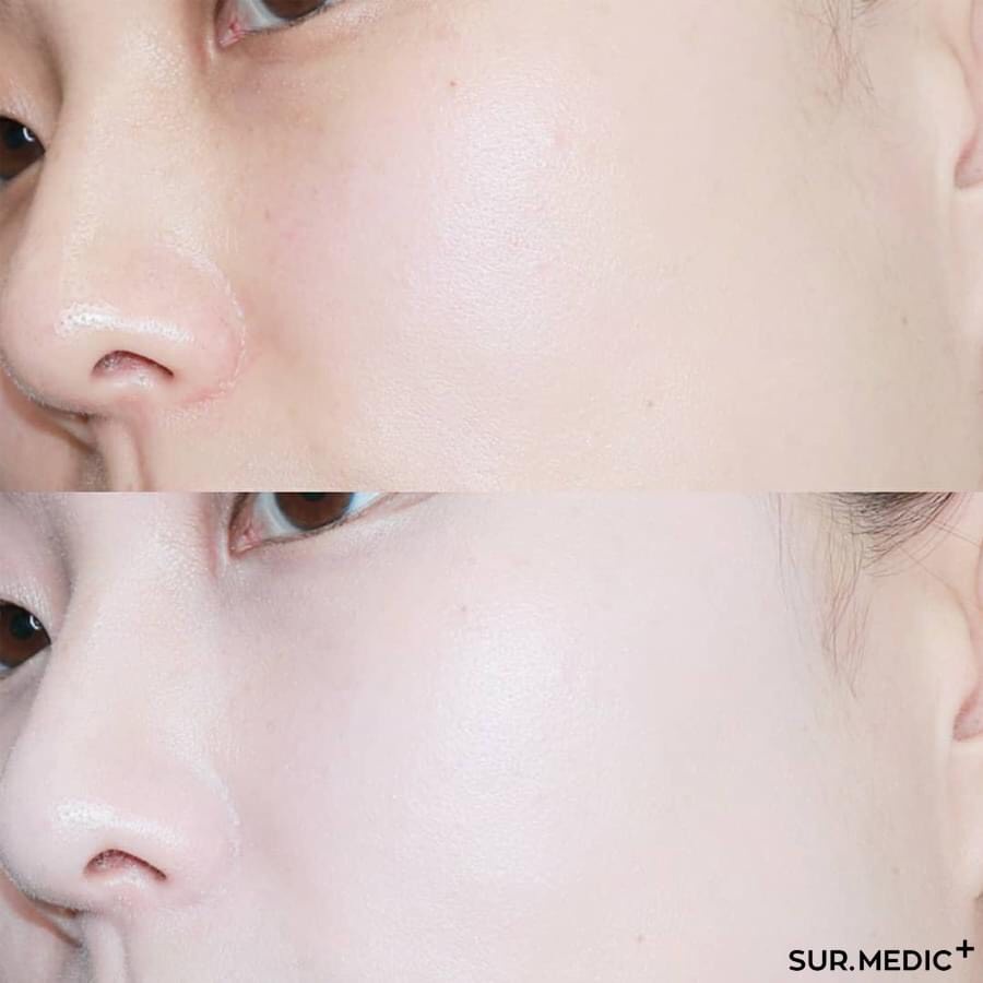 (SALE DATE GẦN 7/2022) Phấn Nước Chống Nắng Sur. Medic Super Ceramide 100 Protection Moisture Sun Cushion spf 50 | BigBuy360 - bigbuy360.vn