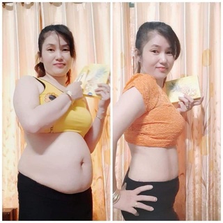 Thạch Dứa Giảm Mỡ Matxi Corp