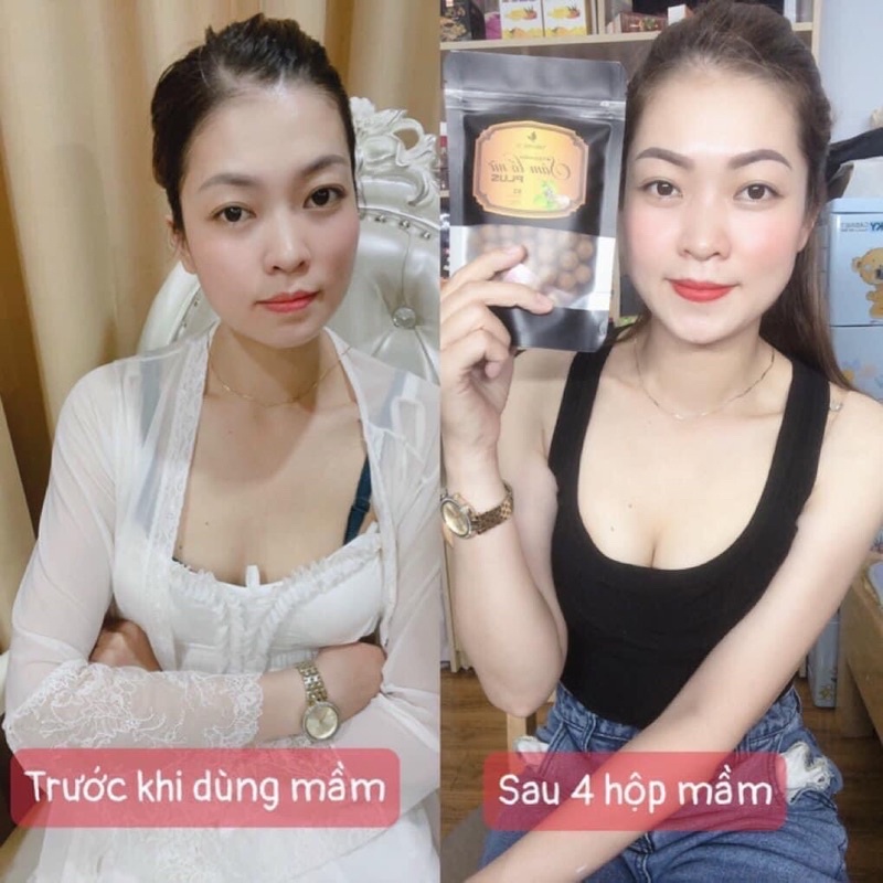 COMBO 10 Kẹo Mầm Sâm Tố Nữ Plus X2 Thảo Mộc 37 +THẺ BẢO HÀNH+ THƯỚC DÂY | BigBuy360 - bigbuy360.vn
