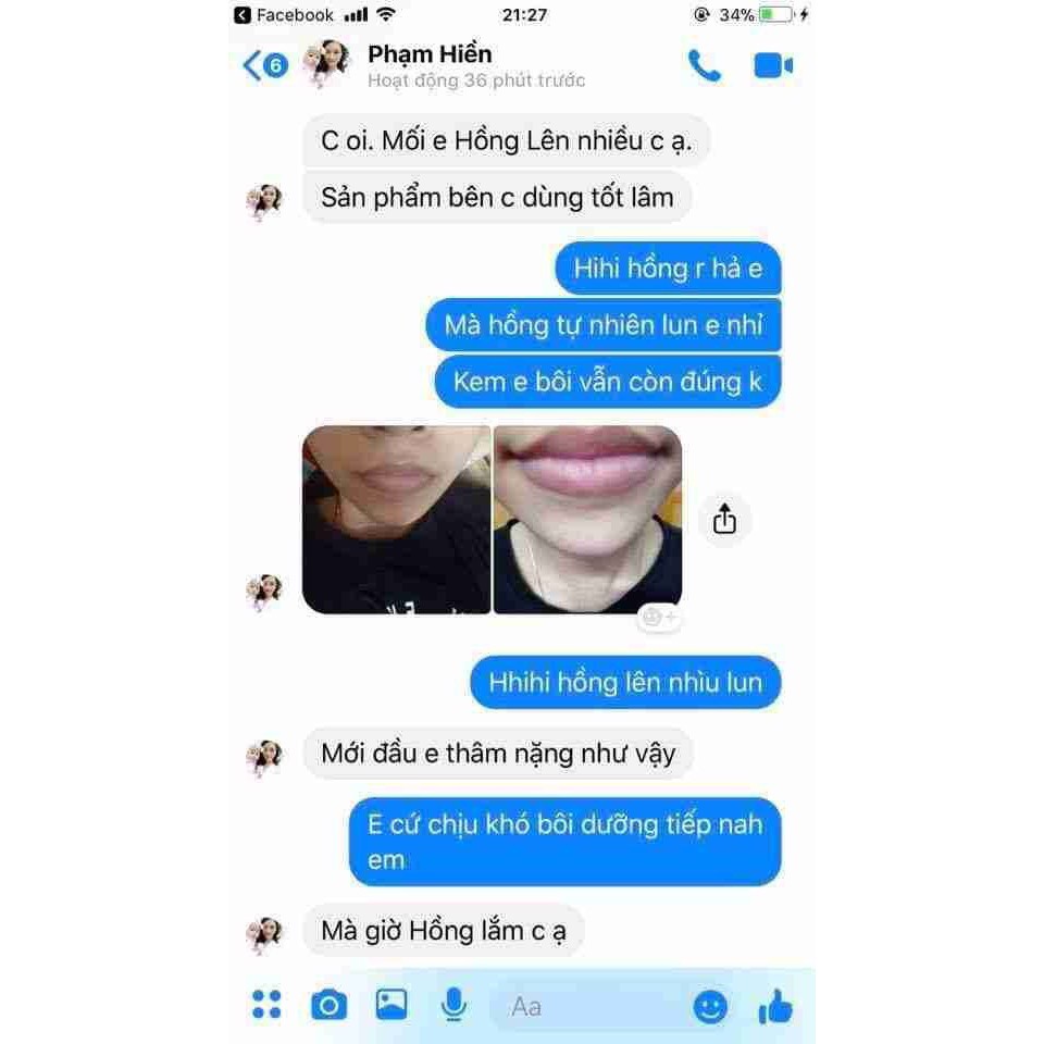 [FREESHIP] Kem khử thâm làm hồng môi Hàn Quốc Xxvirgin 5ml có tác dụng sau 5 ngày | BigBuy360 - bigbuy360.vn