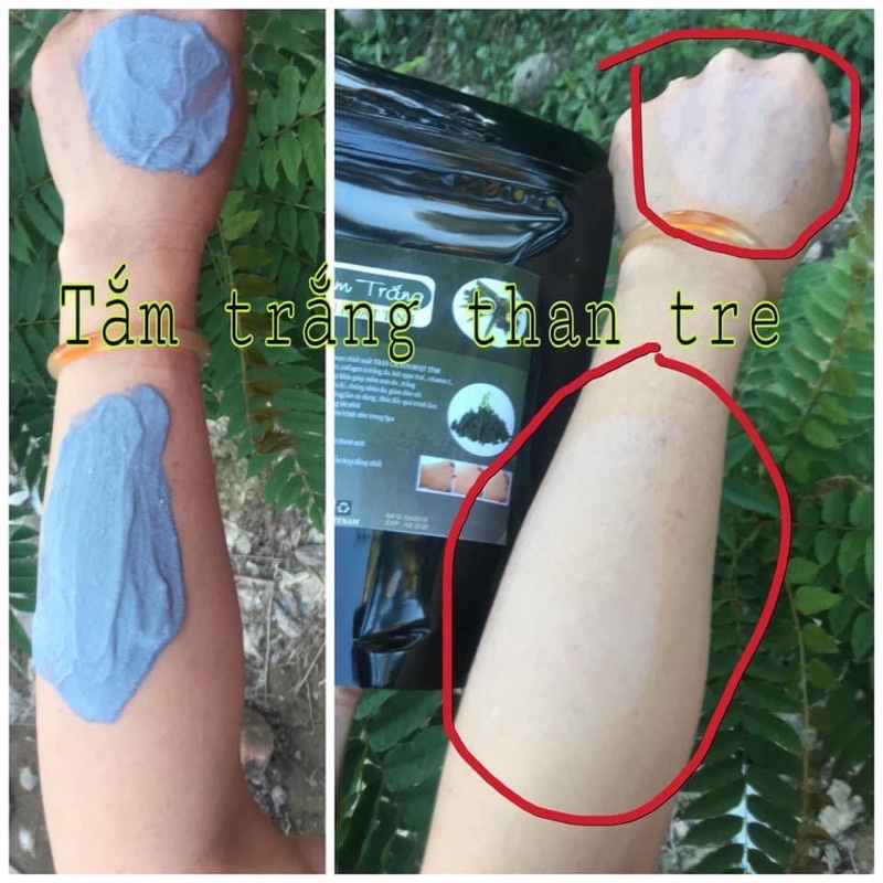 TẮM TRẮNG BODY THAN TRE HOẠT TÍNH