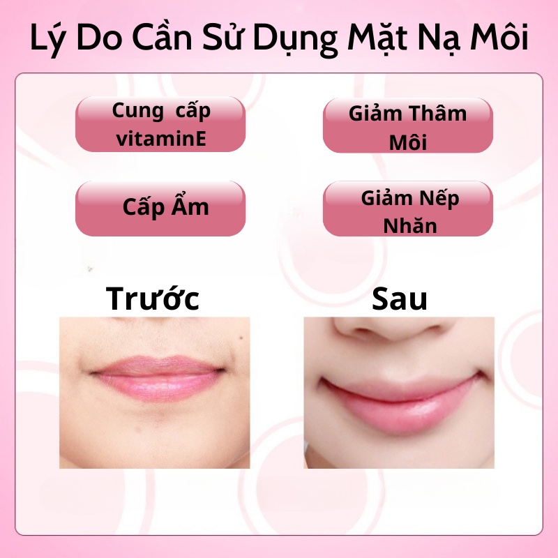 Mặt Nạ Môi Dưỡng Môi Căng Bóng, Mặt Nạ Môi Cấp Ẩm Hồng Hào Cho Môi