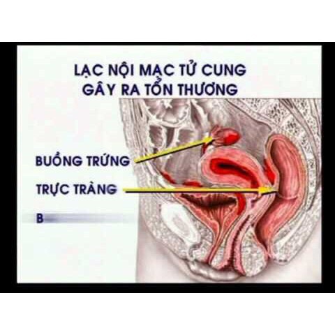Phụ lạc cao EX - Tăng cường lưu thông khí huyết, giảm rối loạn trước, trong và sau kỳ kinh nguyệt (Hộp 30 viên)