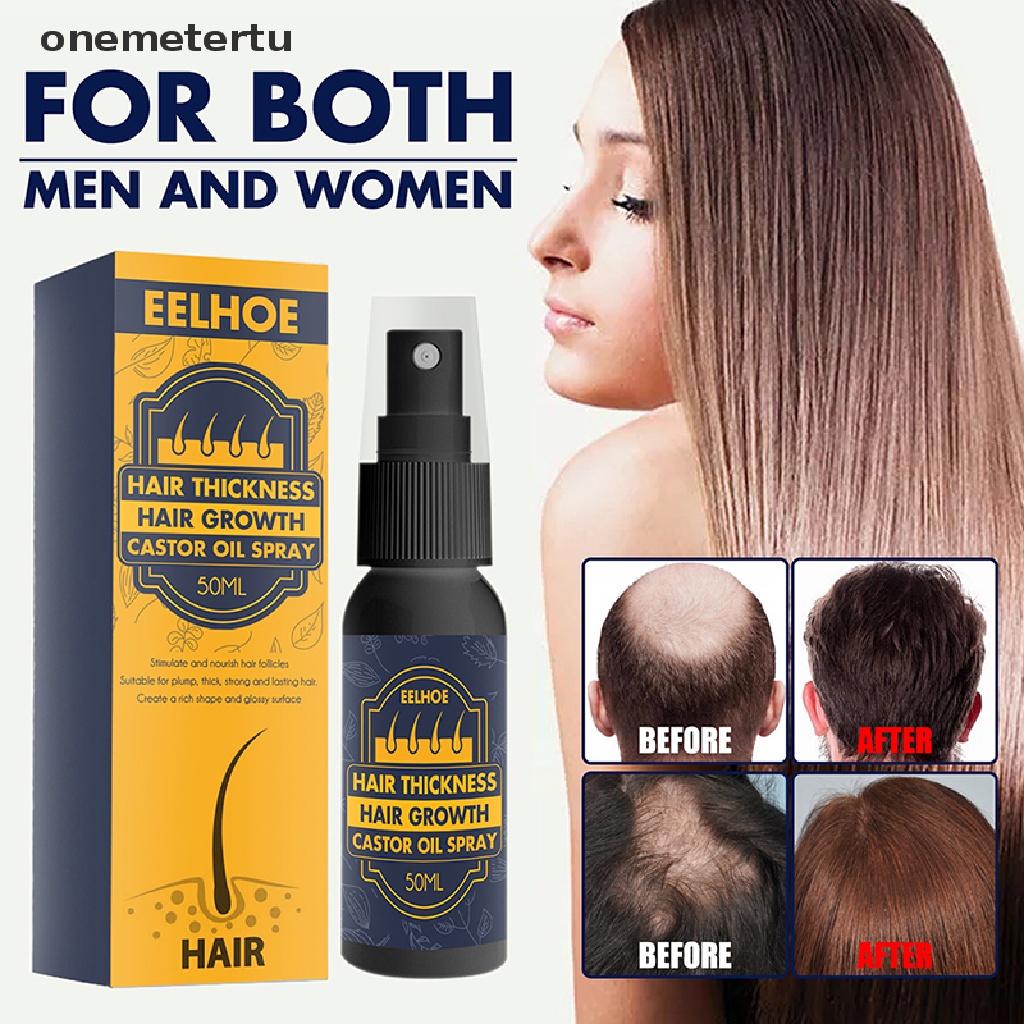 Tinh Dầu Thầu Dầu Kích Thích Mọc Tóc Chống Rụng Tóc onemetertu 50ml